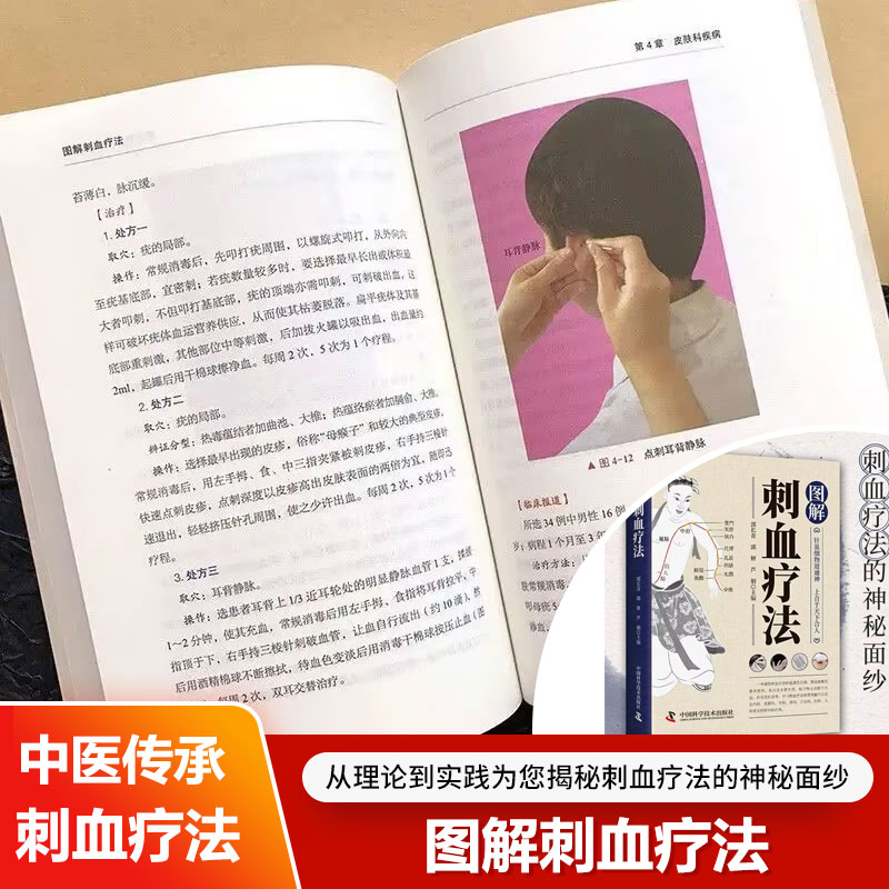 「放血療法」について解説：健康とウェルネスのための伝統中国医 - Therapy Health And Wellness のレビューと価格